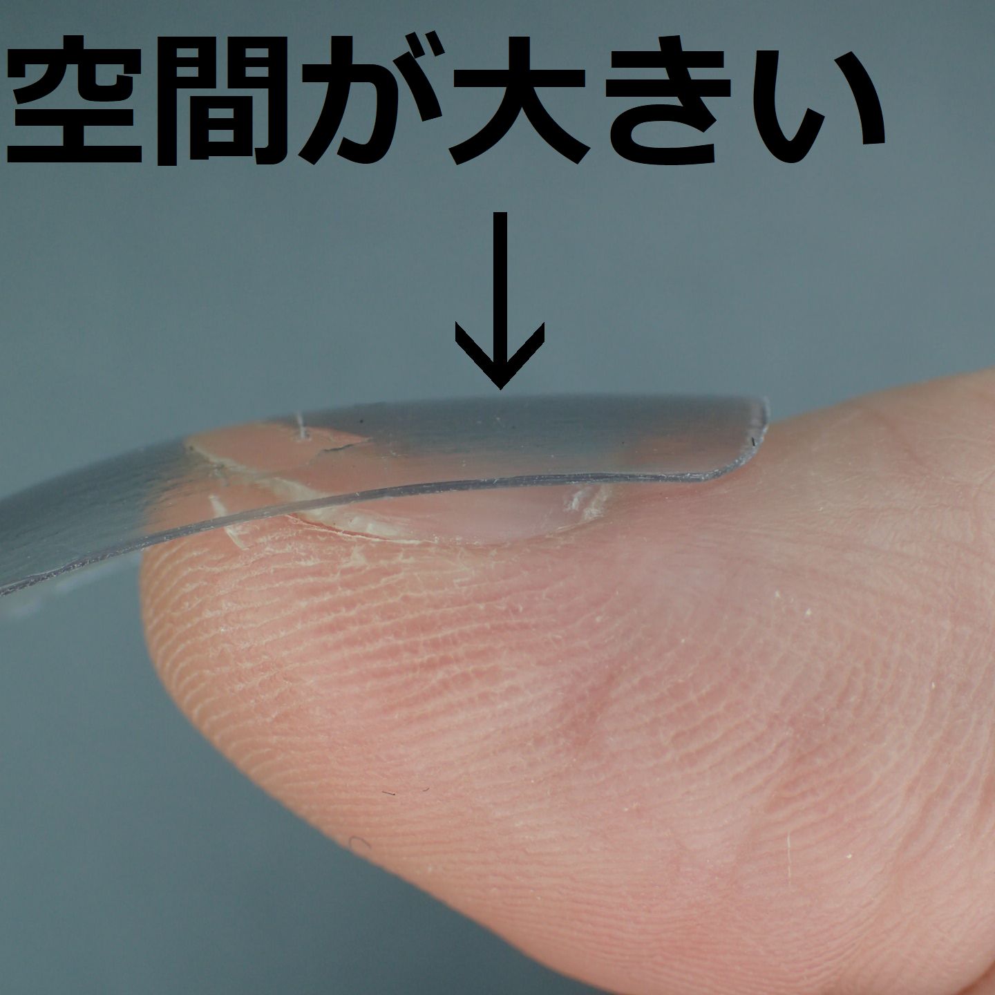 親指の形状
